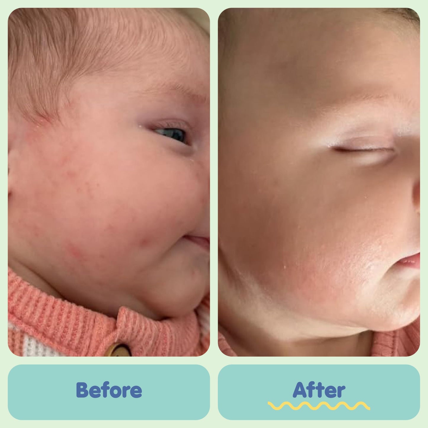TUBBY TODD All Over Ointment - Baby Eczema Cream - Everyday Multi-Purpose Baby Skin Relief Cream - Sensitive Skin, Dry Skin & Irritation - Steroid & Gluten Free - Lavender Rosemary, 2 Pack 3.5oz & 8oz